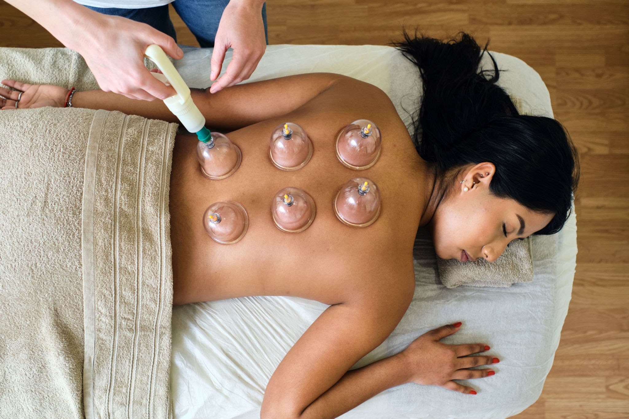 Cupping Therapeutic Massage - Image 1